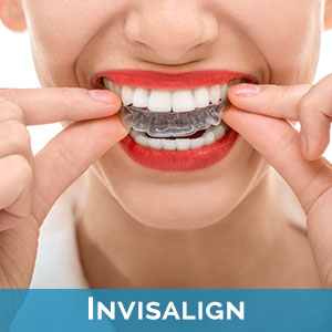 Invisalign