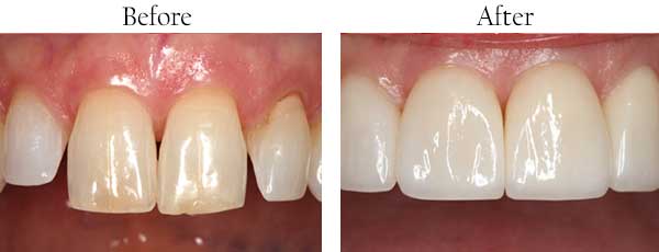 dental images 07083